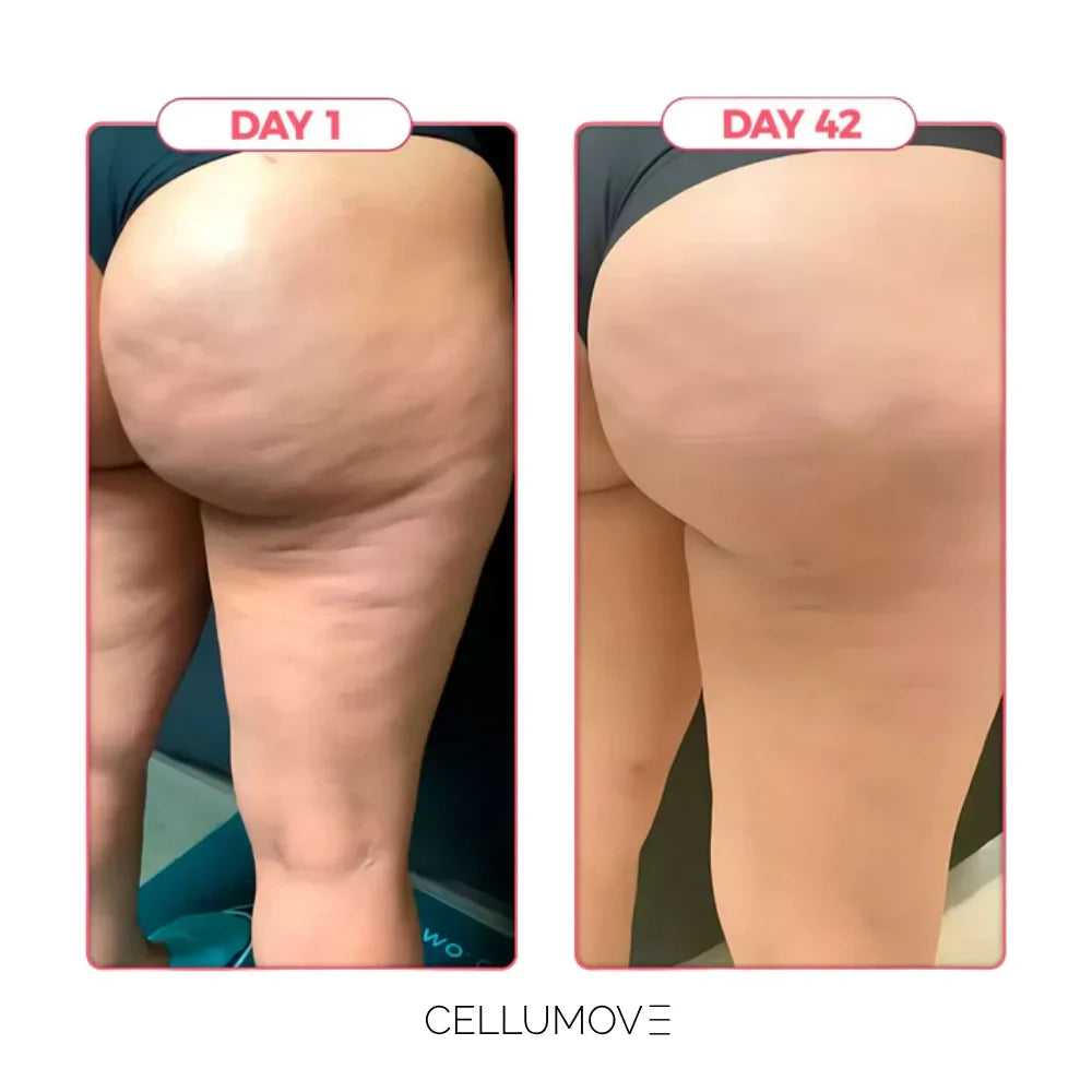 Anti-cellulite Tights -  Redefine your silhouette effortlessly (3-Pack)