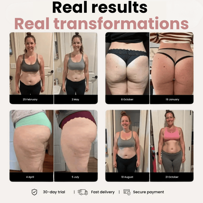 Anti-Cellulite Leggings